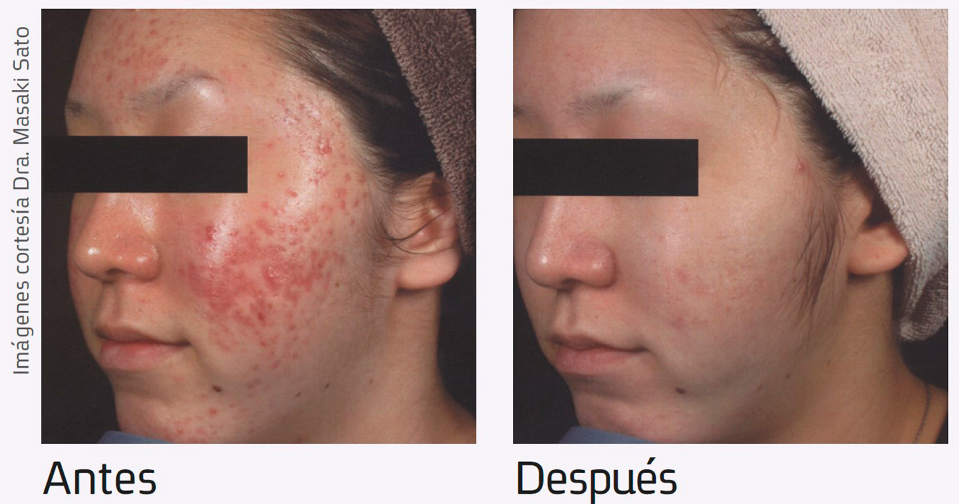 Nur-aesthetics-antes-depois-3