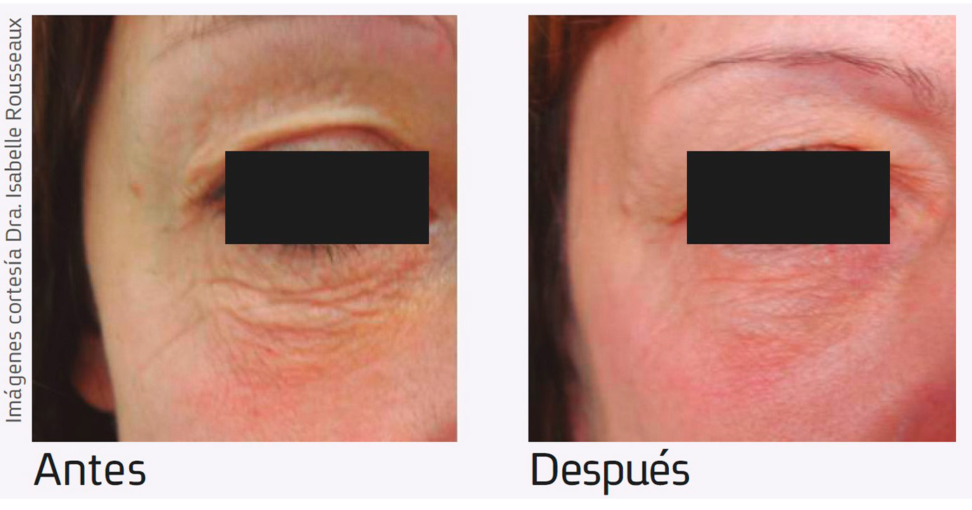 Nur-aesthetics-antes-depois-4