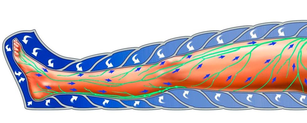 pressoterapia