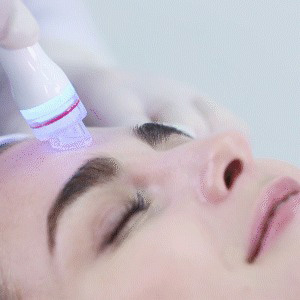 aquapeel-estetica