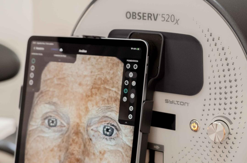 observ 520-x